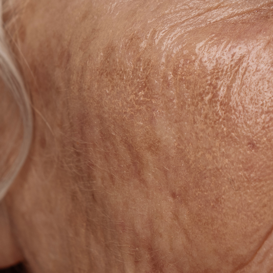 Close up of Caucasian mature skin with visible signs of aging.